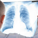 dr-examining-lung-xray.jpg