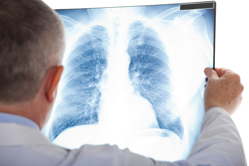 dr-examining-lung-xray.jpg