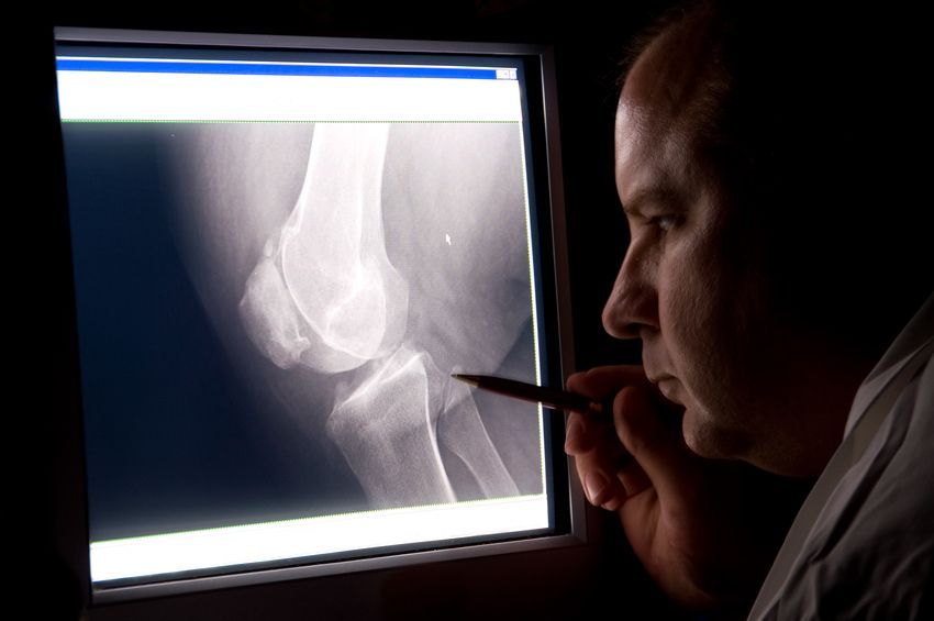 radiologist-examining-xray.jpg