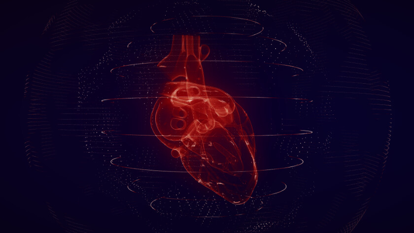 CARDIAC-MRI-1.jpg